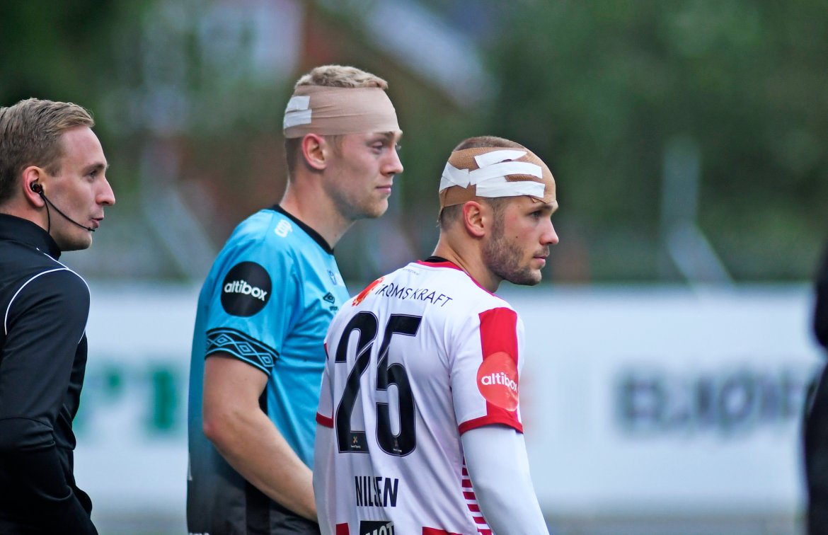 Lasse Nilsen og Vålerengas Henrik Bjørdal måtte begge ut for å få sydd hodet etter hodeduell under eliteseriekampen i fotball mellom Tromsø og Vålerenga på Alfheim Stadion. Foto: Rune Stoltz Bertinussen / NTB